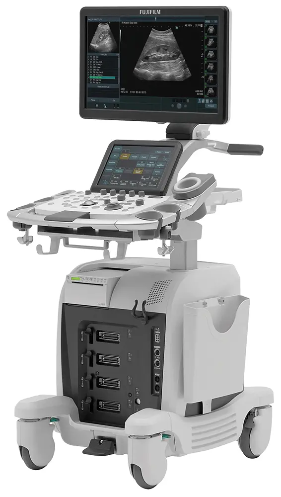 超音波画像検査機器